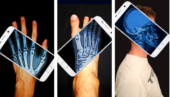 The best apps for making x-rays