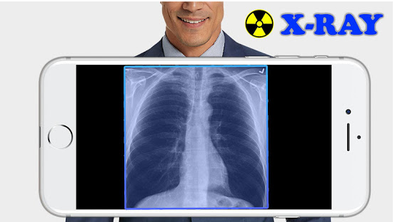 The best apps for making x-rays