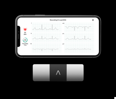 KardiaMobile 6L, technology and safety at your fingertips