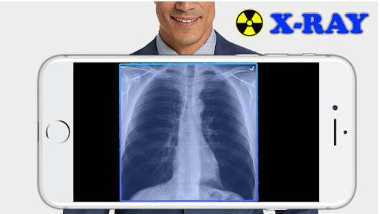Le migliori applicazioni per fare le radiografie