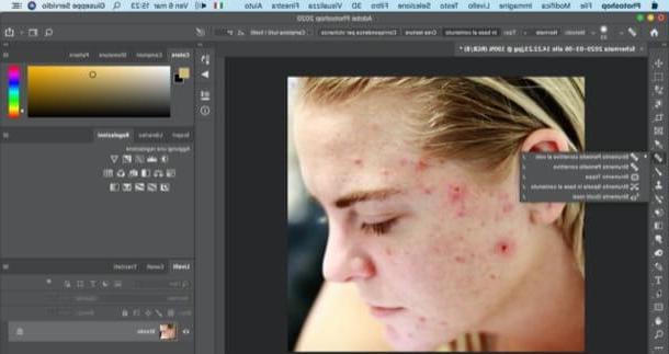 How to remove pimples from photos