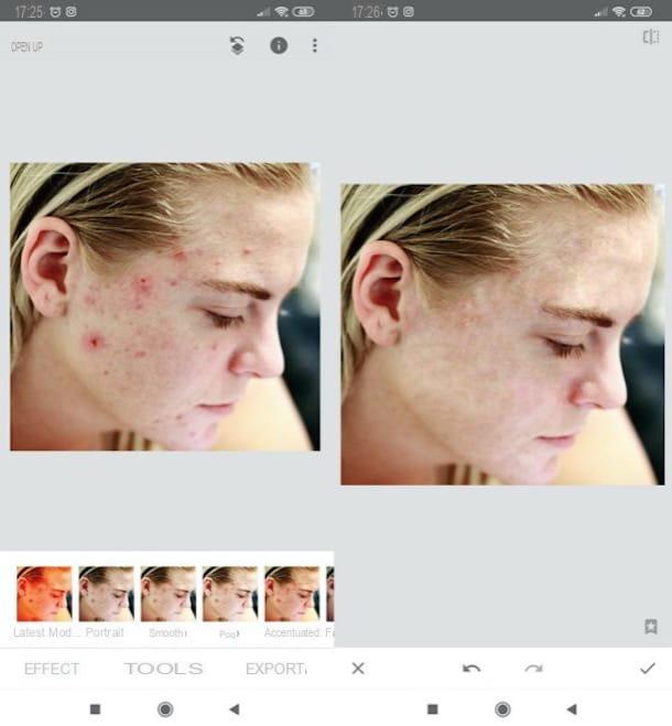 How to remove pimples from photos