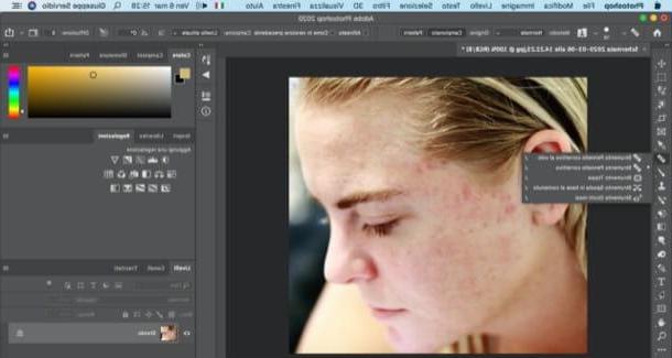 How to remove pimples from photos