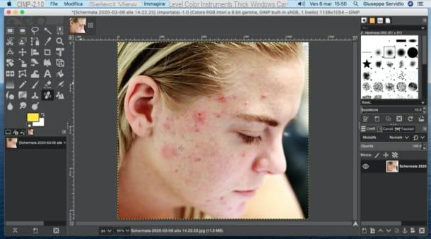 How to remove pimples from photos