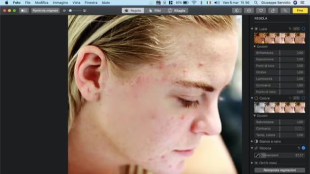 How to remove pimples from photos