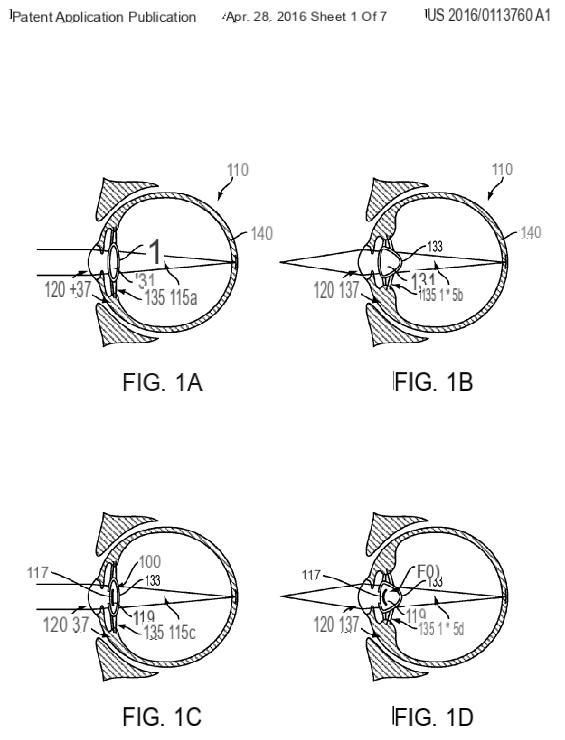 Google patenta el ojo biónico