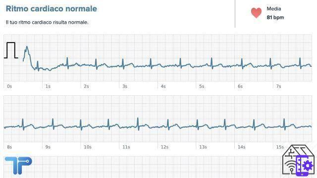 Revisión de Fitbit Sense: es inteligente pero a veces no se aplica